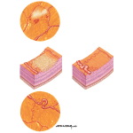 Hypoxic Vascular Lesions