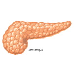 Pathogenesis of Diabetic Retinopathy