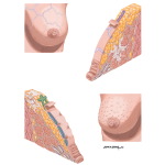 Clinical Signs of Cancer