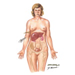 Diagnostic Considerations in Fever of Unknown Origin