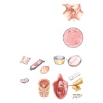 Dysuria
