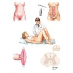 Myofascial Syndromes