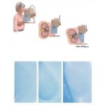 Mammography