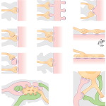 Types of Synapses