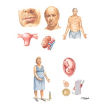 Complications Common to All Transplantations