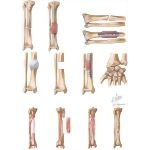 Surgical Management of Nonunion