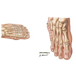 Amputation of Foot