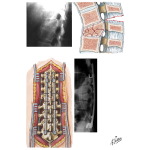 Unstable Fracture of Thoracolumbar Spine