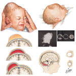 Action of Drugs On Nerve Excitability