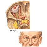 Ocular Complications of Diabetes