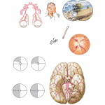 Ocular Signs of Large Vessel Disease