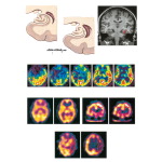 Neuroimaging Studies