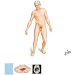 Ischemia In Vertebrobasilar Territory: Clinical Manifestations