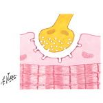 Myasthenia Gravis: Pathophysiologic Concepts