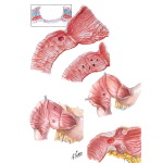 Duodenitis and Duodenal Ulcers