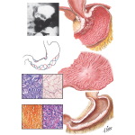 Cancers of the Stomach