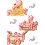 Principles of Gastric Surgery