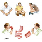 Disaccharide Intolerance