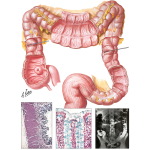 Topography and Structure of the Colon