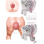 Labeled image