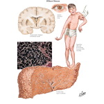 Jones 1E image