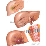 Labeled image