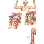Rupture of the Biceps Brachii Muscle