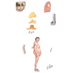Cushing's Syndrome