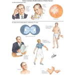 Jones 1E image