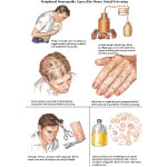 Jones 1E image