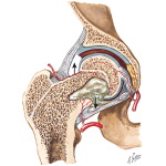 Septic Arthritis Secondary to Concomitant Osteomyelitis