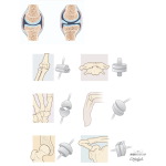 Types of Joints