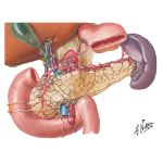 Pancreas