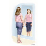 Obesity