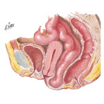 Enterocele