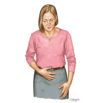 Irritable Bowel Syndrome (IBS)