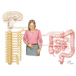 Irritable Bowel Syndrome (IBS)