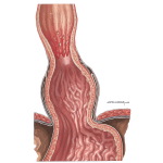 Esophagus