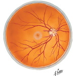 Intrinsic Arteries and Veins of Eye