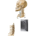 Bony Framework of Head and Neck