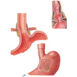 Esophagogastric Junction