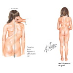 Labeled - Orthopedic image