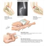 Labeled - Orthopedic image