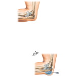 Minor Procedures On the Elbow