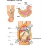 Labeled - Orthopedic image