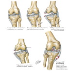 Labeled image