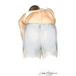 Scoliosis: What You Might Notice