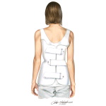 Scoliosis: How An Orthosis Works