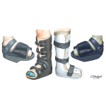 Walking Cast