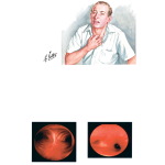 Clinical Features of Asthma